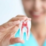 Come sostituire i denti mancanti