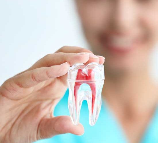 Come sostituire i denti mancanti