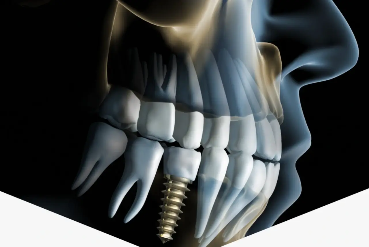 Studio odontoiatrico Dott.ssa Giusy Minutoli